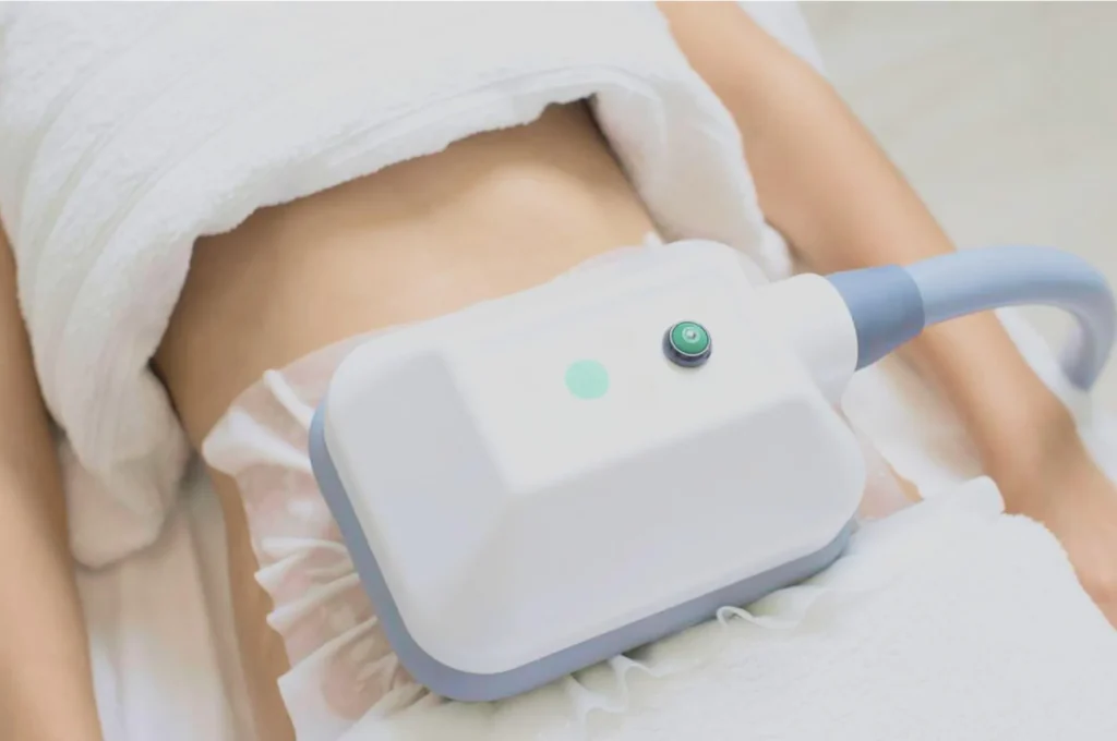 How Fat Freezing and HIFU Work Together? 3 advantages to combining Fat Freezing and HIFU Tilbury