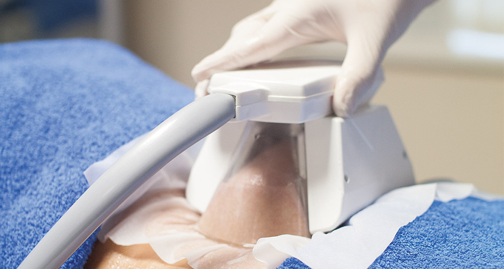 How Fat Freezing and HIFU Work Together? 2 Multiple Areas in One Session HIFU and Fat Freezing Tilbury
