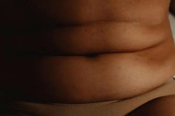 The Hidden Connection: How Stress Shapes Your Fitness and Body Composition 3 image of what stress can do on the stomach area and how Lipo 360 Tilbury can help to change your body shape.